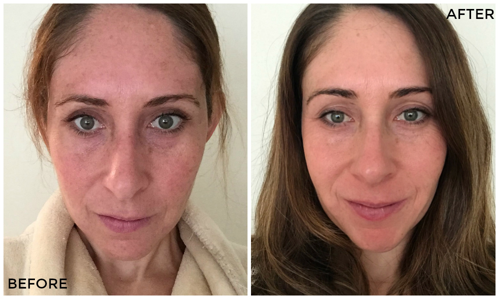 Photo of Andie before and after using the Trophy Skin system.