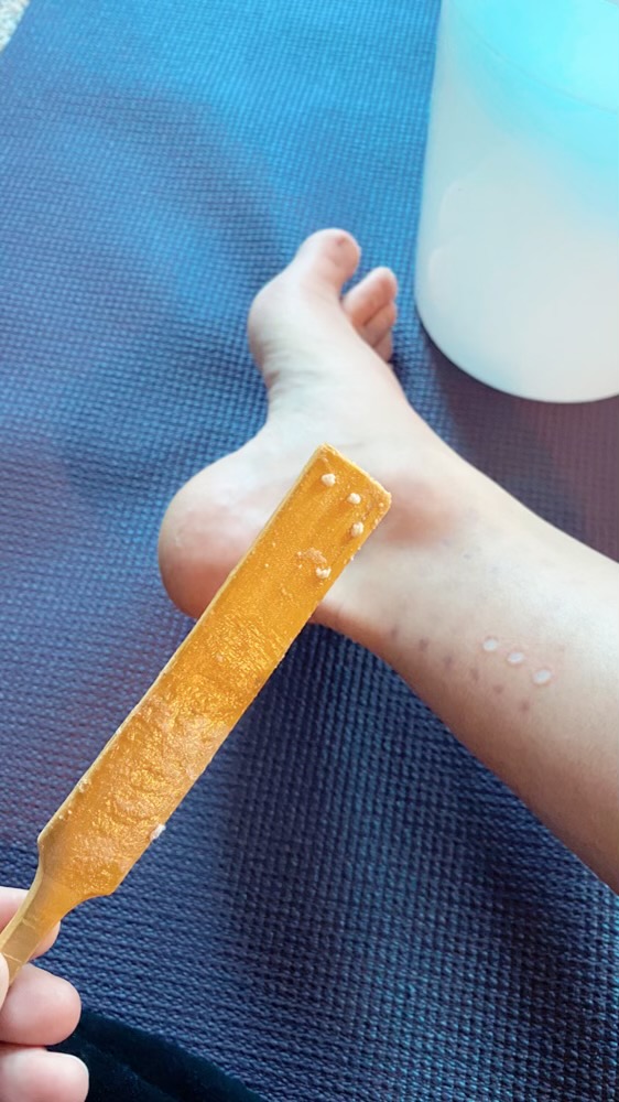 Kambo being applied to open wounds on the leg and a photo of a Kambo secretion stick.